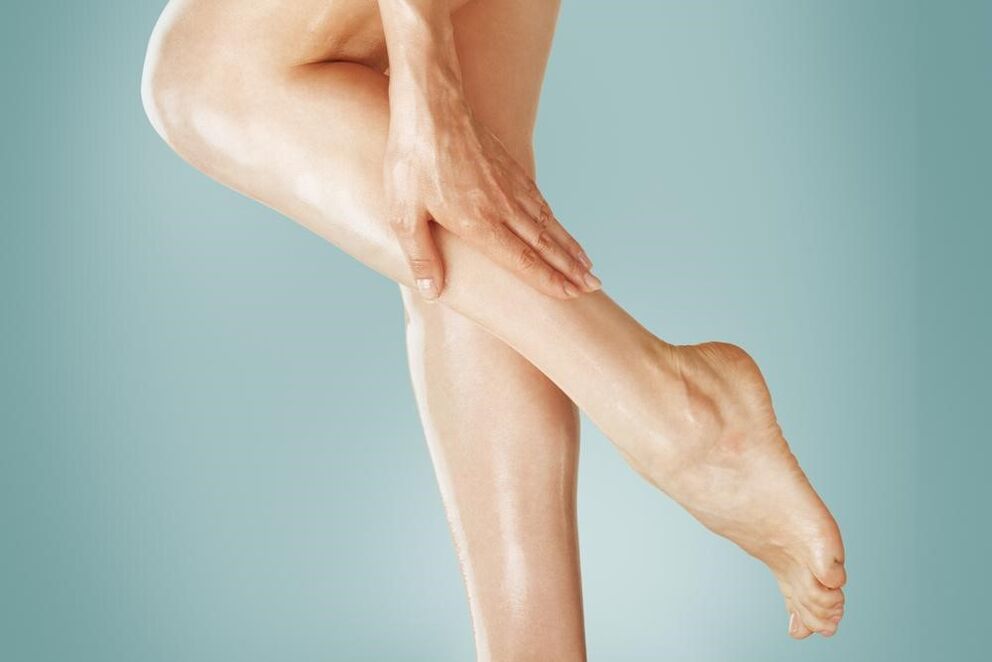 Leg injury from varicose veins