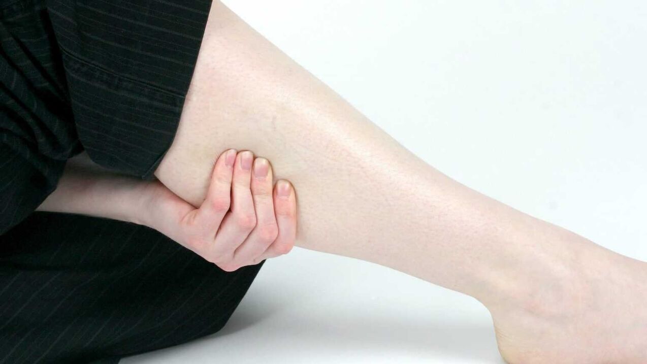 heavy legs, varicose veins